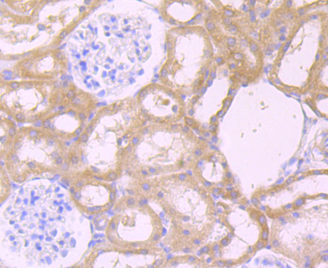 CXCR5 Rabbit mAb