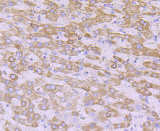 NDUFB8 Rabbit mAb