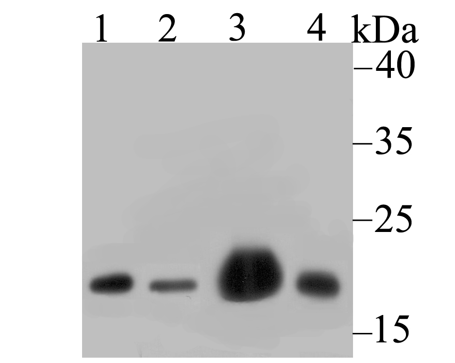 NDUFB8 Rabbit mAb