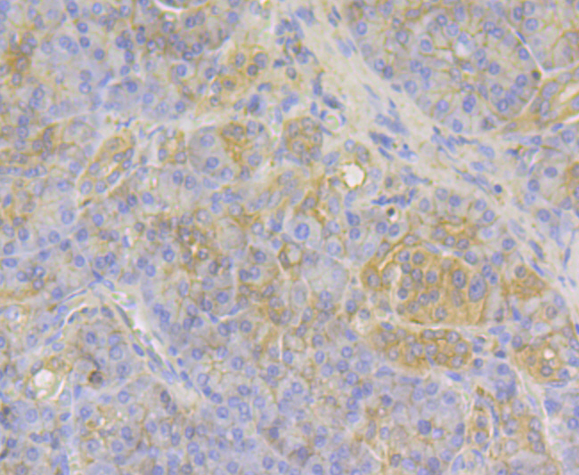 MGEA5 Rabbit mAb