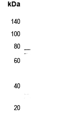 IRAK1 (phospho-Thr100) Antibody