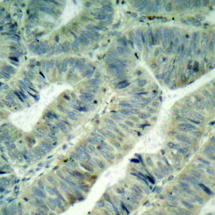 c-SRC/FYN/c-YES (phospho-Tyr419/420/426) Antibody