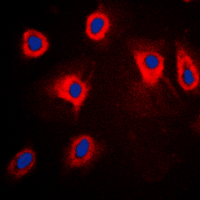 TPL2 (phospho-Thr290) Antibody