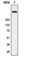 Ryanodine Receptor 2 (phospho-Ser2808) Antibody