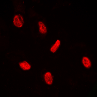 PE2 (phospho-Thr526) Antibody