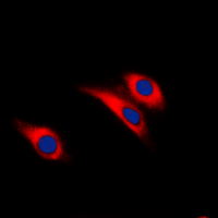 Insulin Receptor (phospho-Tyr1361) Antibody