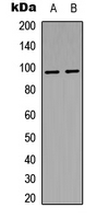 Insulin Receptor (phospho-Tyr1361) Antibody