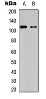 PRKD1/2/3 (phospho-Ser738/Ser742) Antibody