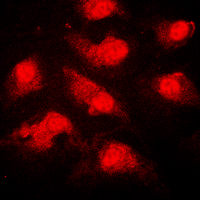 NEK9 (phospho-Thr210) Antibody