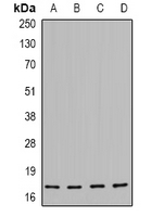 HSP20 (phospho-Ser16) Antibody