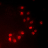 MKI67IP (phospho-Thr234) Antibody