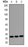 MKI67IP (phospho-Thr234) Antibody