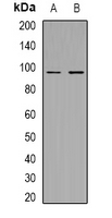 MERTK (phospho-Tyr753/685) Antibody