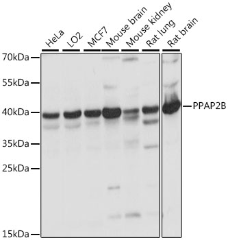 PPAP2B Polyclonal Antibody