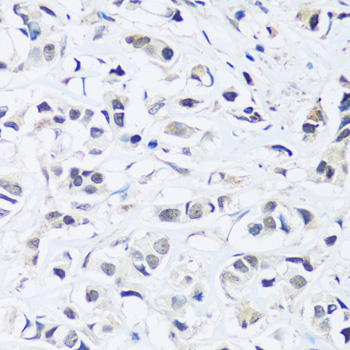 ARL6IP4 Polyclonal Antibody