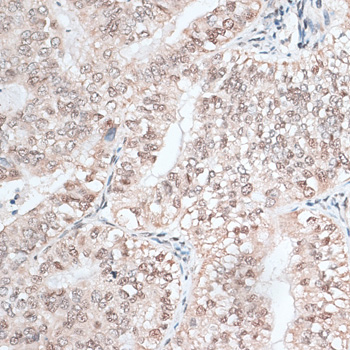 RBM3 Polyclonal Antibody