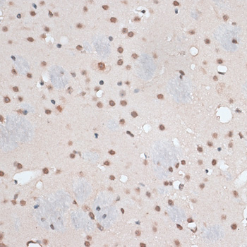 RBM3 Polyclonal Antibody