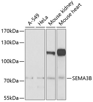 SEMA3B Polyclonal Antibody