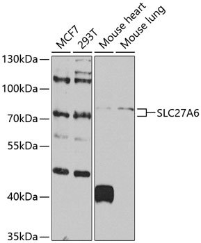 SLC27A6 Polyclonal Antibody