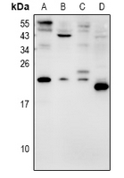 AVP Antibody