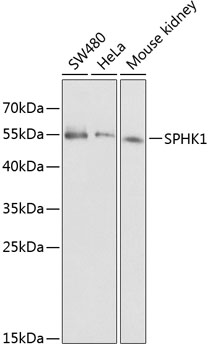 SPHK1 Antibody