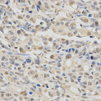 SPHK1 Antibody