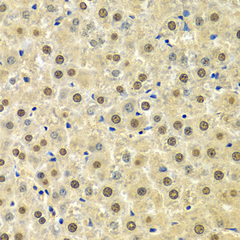 SPHK1 Antibody