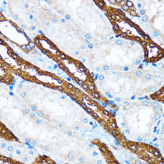 PIK3CA antibody