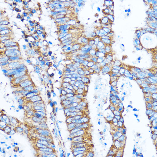 PIK3CA antibody