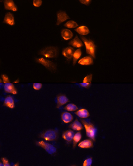 TIM-3/HAVCR2 Rabbit Polyclonal Antibody