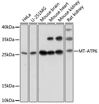 MT-ATP6 Rabbit Polyclonal Antibody