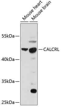 CALCRL Rabbit Polyclonal Antibody