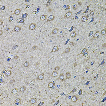 COL1A2 Rabbit Polyclonal Antibody