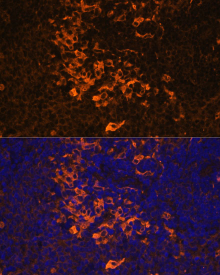 IL1 beta Rabbit Polyclonal Antibody