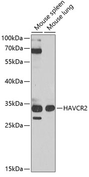 TIM-3/HAVCR2 Rabbit Polyclonal Antibody