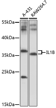 IL1 beta Rabbit Polyclonal Antibody