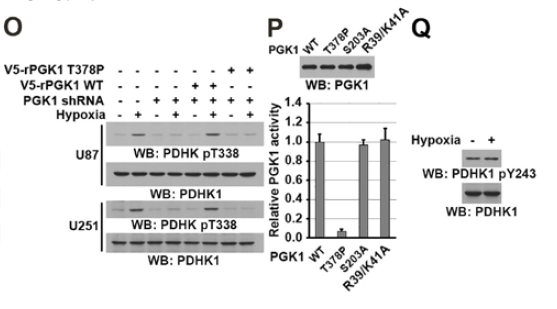 PDHK1(Phospho-Tyr243) Antibody