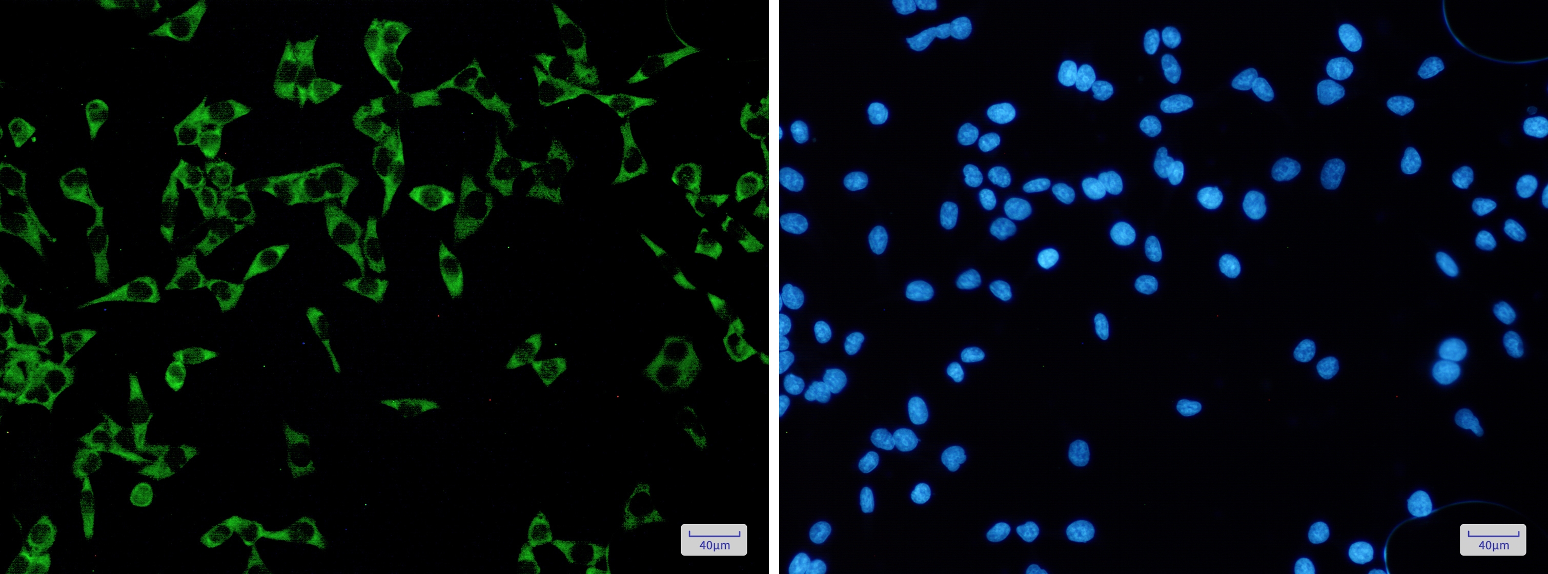 FMRP Rabbit mAb