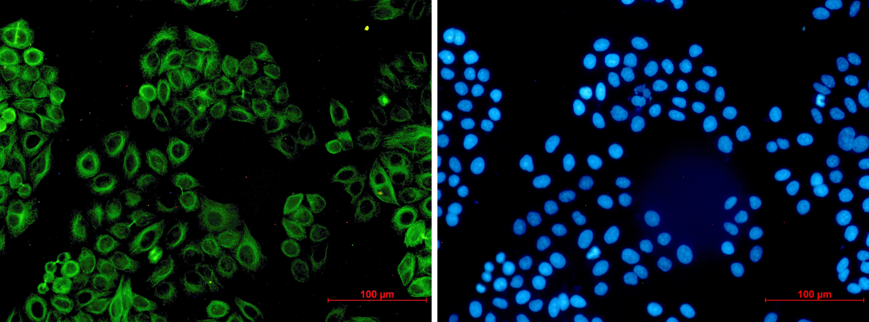 Activin A Receptor Type IB Rabbit mAb