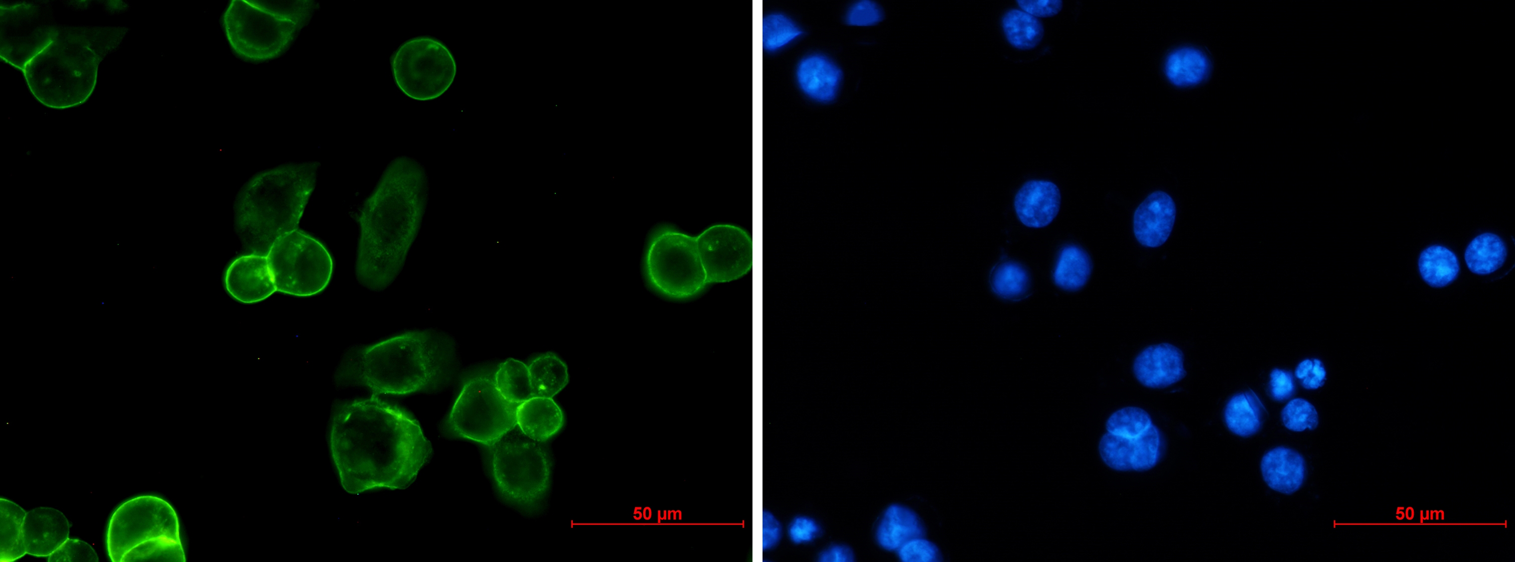 EpCAM Rabbit mAb