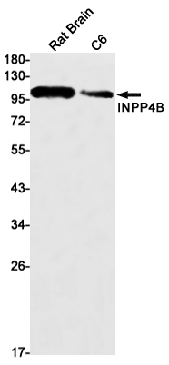 INPP4B Rabbit mAb