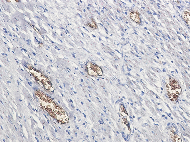 PACSIN3 Rabbit mAb