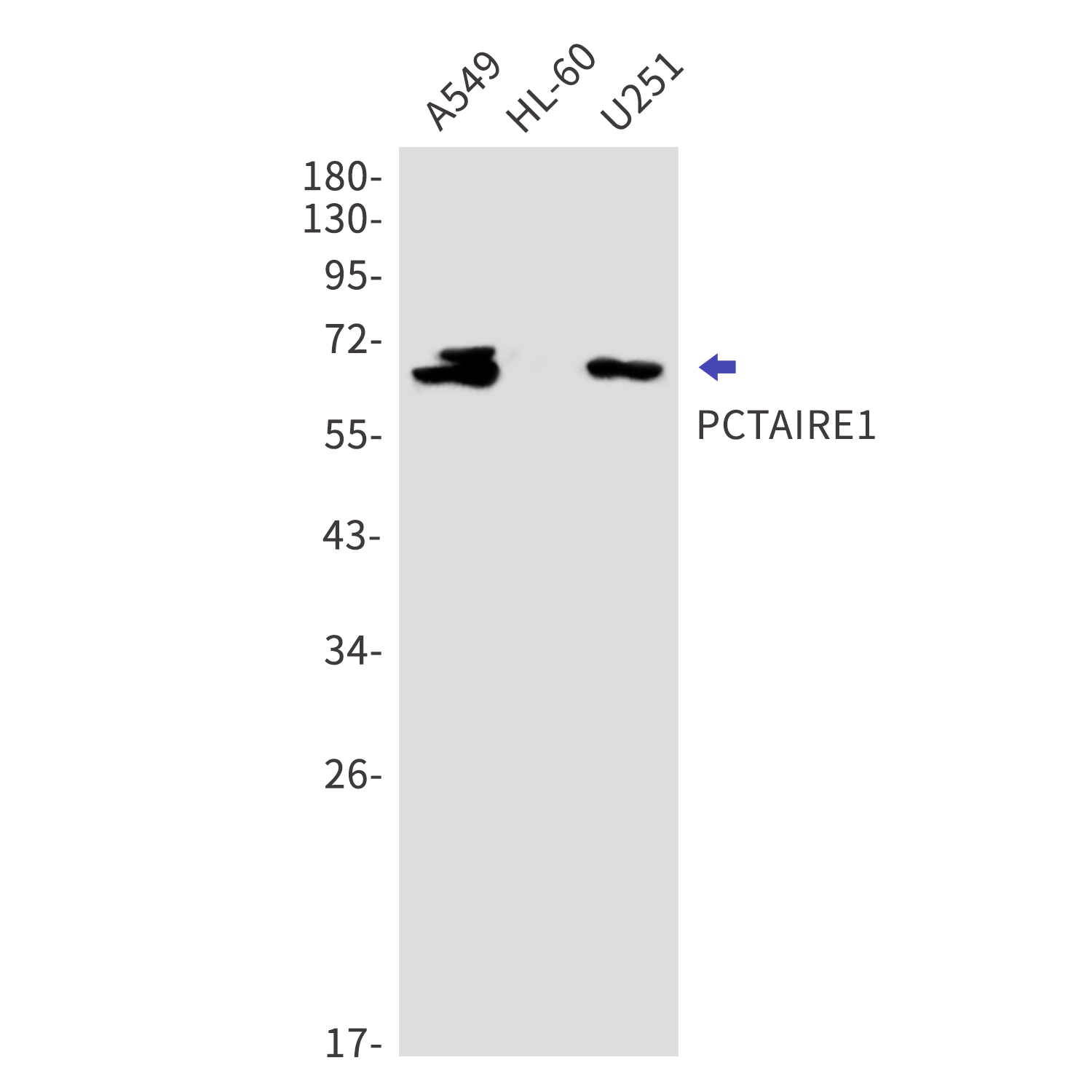 CDK16 Rabbit mAb