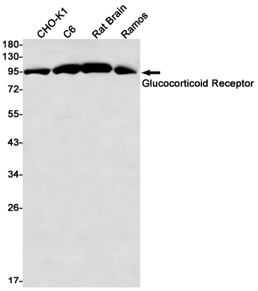 Glucocorticoid Receptor Rabbit mAb