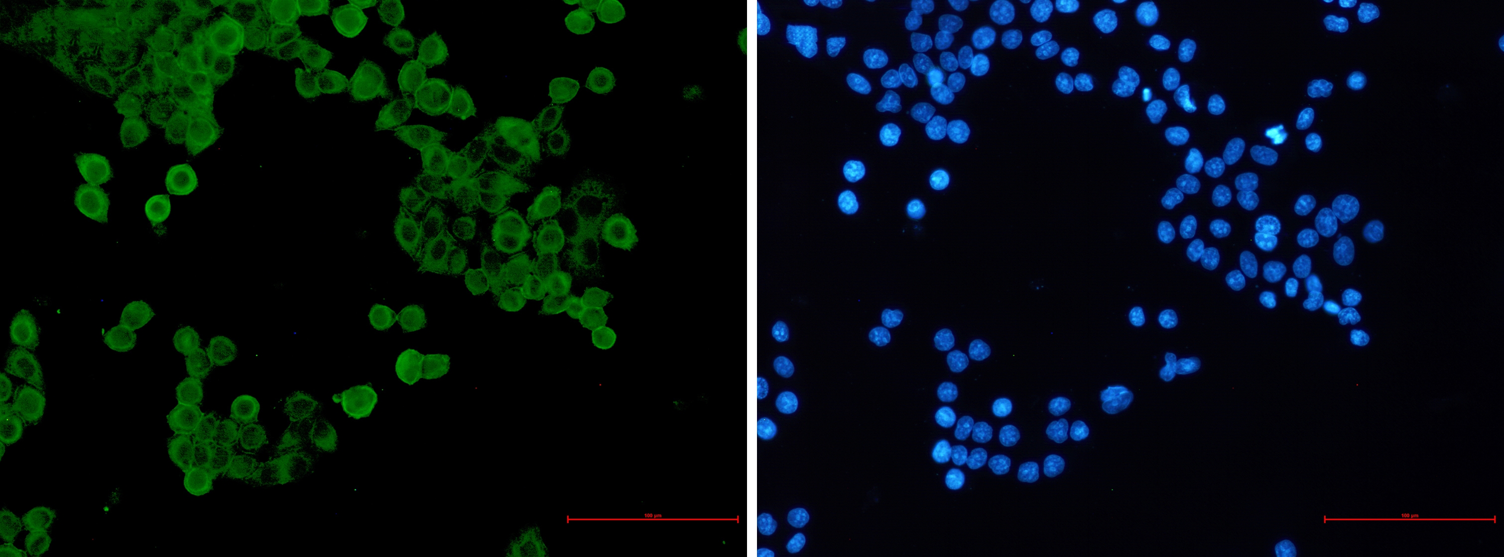 Phospho-AMPK alpha 1 (Ser496) Rabbit mAb