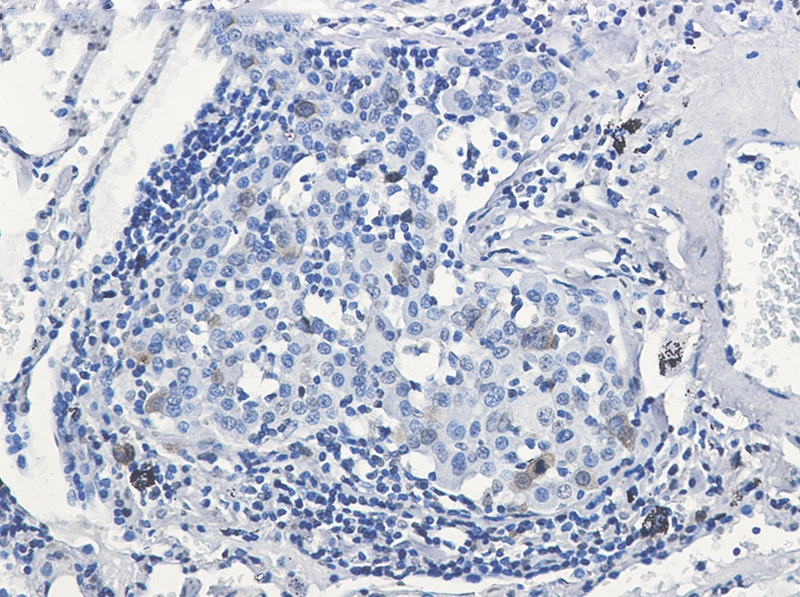 Phospho-CDK1/2 (Thr14) Rabbit mAb