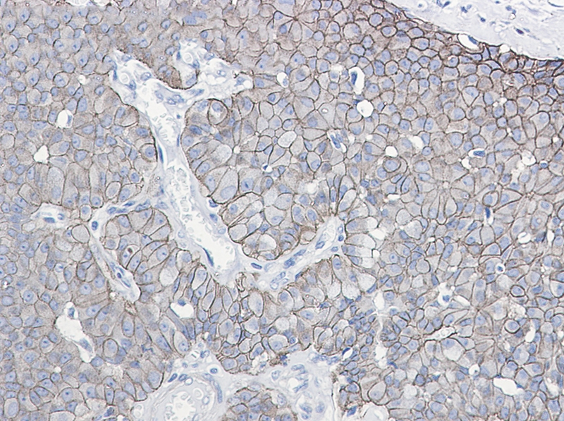 Phospho-E Cadherin (Ser838/Ser840) Rabbit mAb