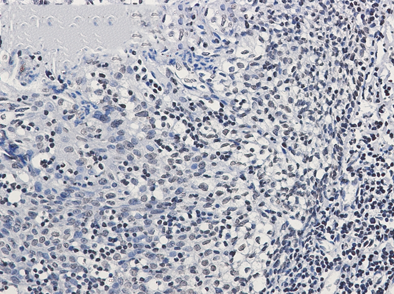 Phospho-Glucocorticoid Receptor (Ser226) Rabbit mAb