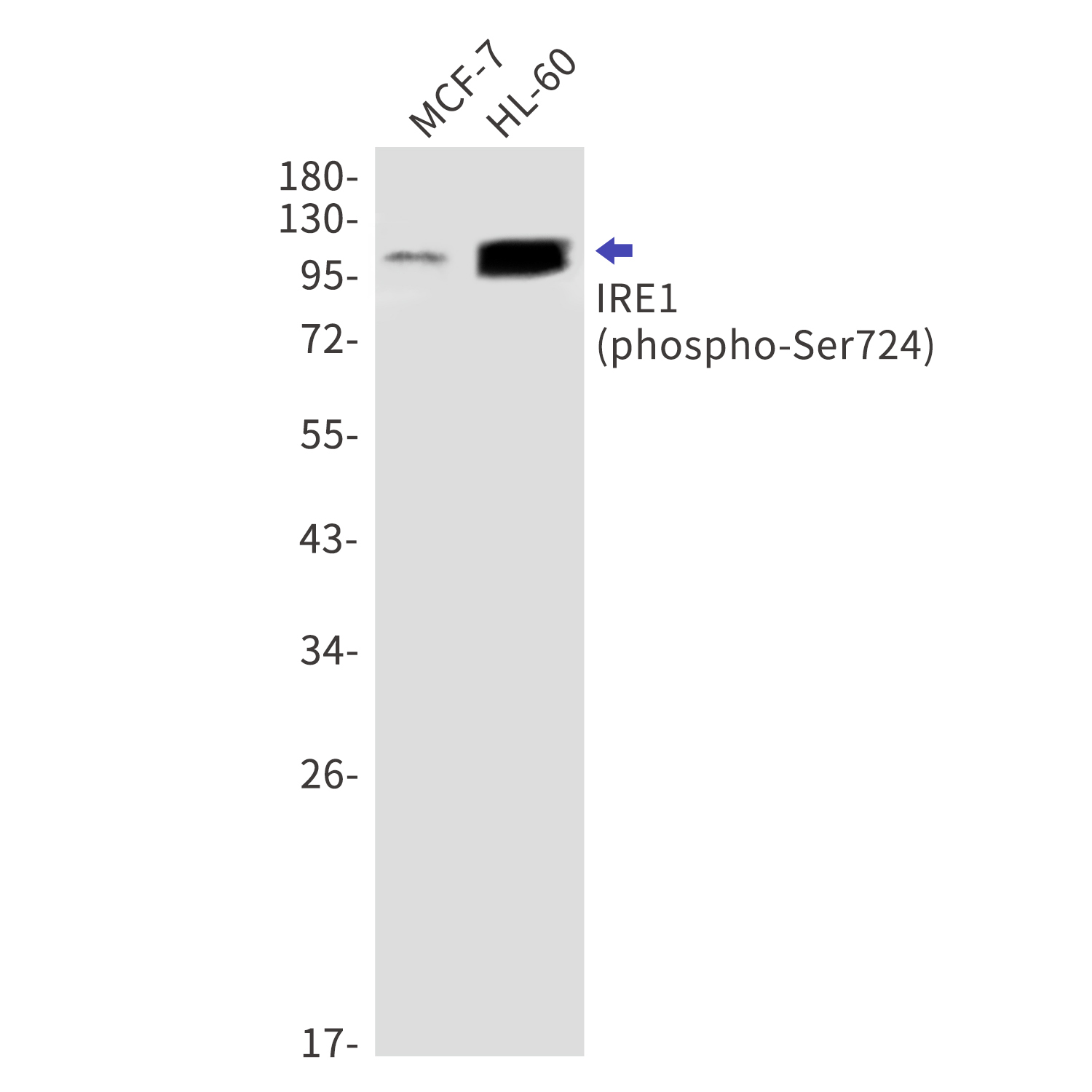 Phospho-IRE1 (Ser724) Rabbit mAb