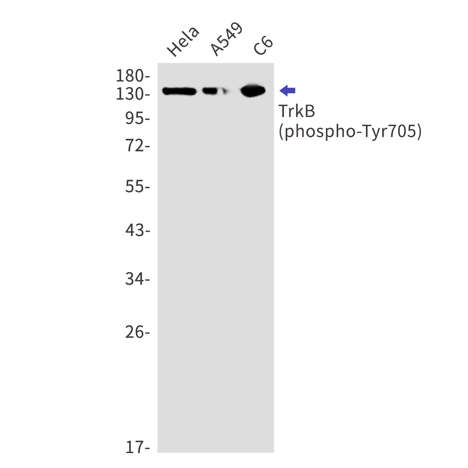 Phospho-TrkB (Tyr705) Rabbit mAb